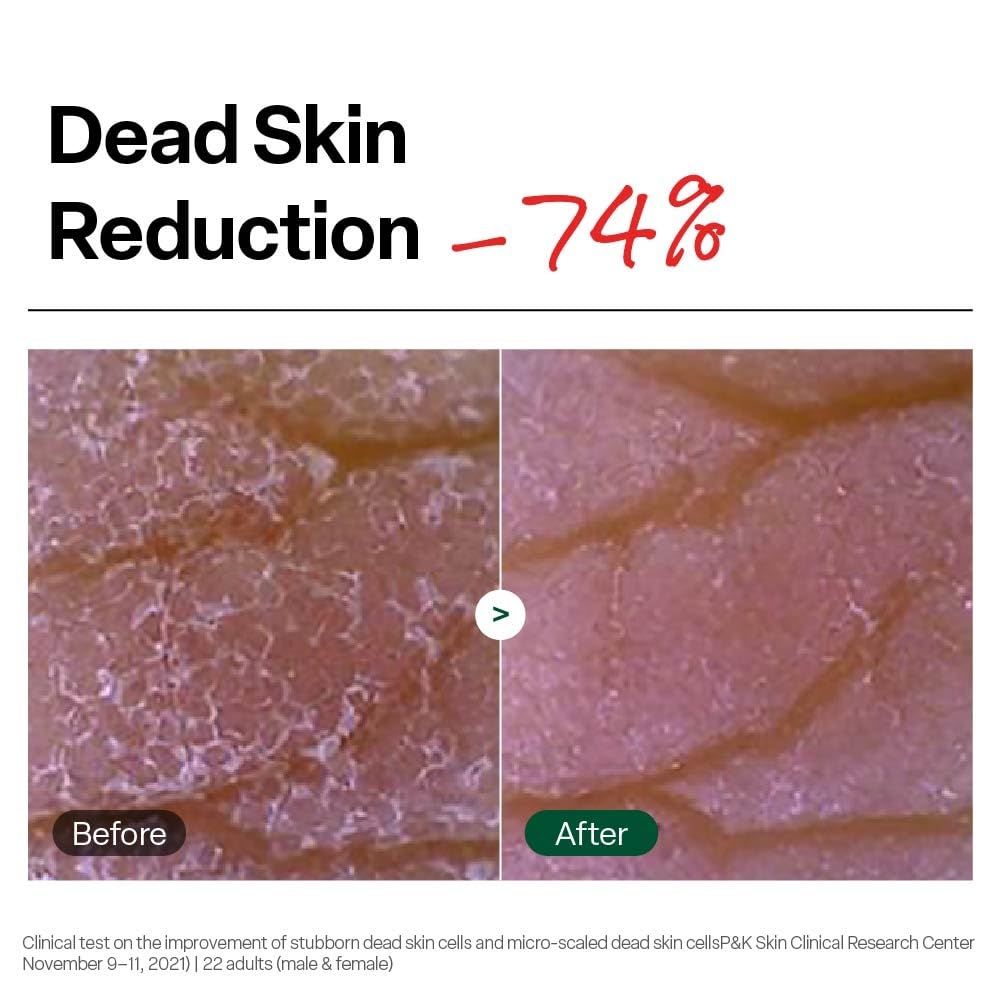 Dr.G Brightening Peeling Gel 120g